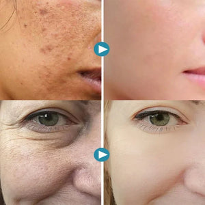 GEL FACIAL