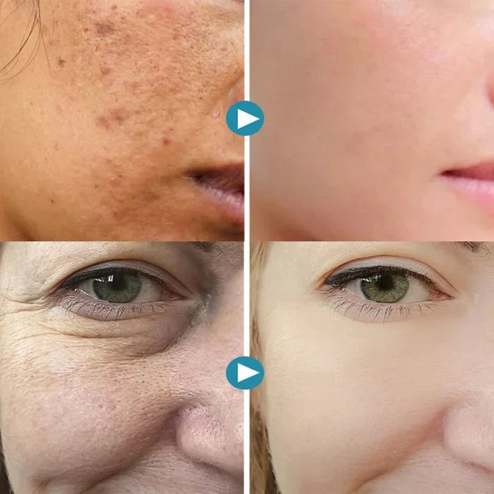 GEL FACIAL