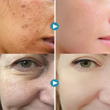 GEL FACIAL